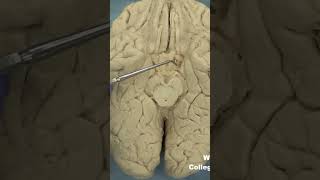 Parahippocampal gyrus uncusanatomyneuroanatomy cerebrumbraincortextemporallobelimbicsystem [upl. by Hadihsar]