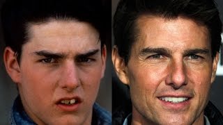 20 Photos Of Celebrities Teeth before amp after That prove good teeth means good face [upl. by Suzann]