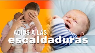 Las escaldaduras en los bebés  síntomas causas y soluciones [upl. by Arretal965]