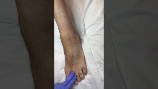 The most satisfying foot wax 😮‍💨 waxingexpert waxing waxer esthetician [upl. by Socem]