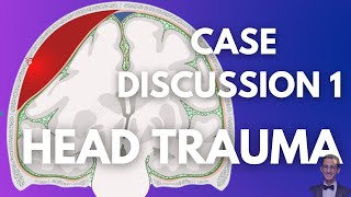 Case Discussion Neurosurgery  Head Trauma  Case 1 [upl. by Brodench]