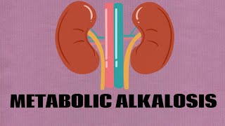 Metabolic alkalosis  Hypokalemia [upl. by Ronda]