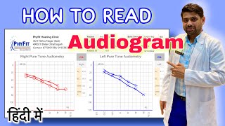 How to read Audiogram  Explained in Hindi  सुनाई की जाँच Audiometry test रिपोर्ट को कैसे पढ़ें [upl. by Naiva576]