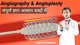 जानिए Angiography amp Angioplasty kya hai or kaise hoti hai  Angiography test procedure  angioplasty [upl. by Richela]