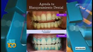 Procedimiento para Blanqueamiento Dental [upl. by Blalock808]