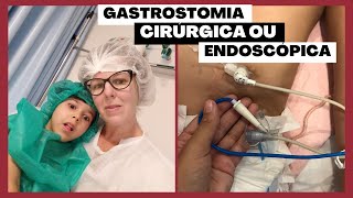 GASTROSTOMIA CIRÚRGICA OU ENDOSCÓPICA Qual forma escolher [upl. by Ynettirb]