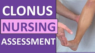 Clonus Test Positive Reflex Sign Preeclampsia Pregnancy  Nursing Skills [upl. by Eitsym]