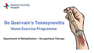 Management of De Quervains Tenosynovitis Home Exercise Programme and Splinting [upl. by Eceinert]