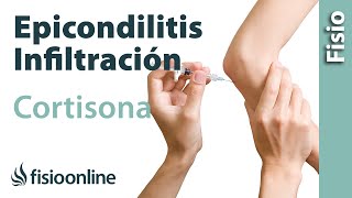 Epicondilitis o codo de tenista y las infiltraciones de cortisona o corticoides [upl. by Latsyrhc248]