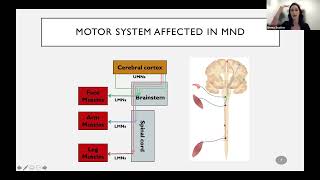 Motor Neuron Disease Who develops it why and what we are doing about it [upl. by Glad137]