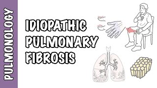 Idiopathic Pulmonary Fibrosis  pathophysiology signs and symptoms investigation and treatment [upl. by Etteroma]