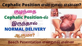 breech presentation in tamil  cephalic position in pregnancy  Cephalic in tamil [upl. by Brocky]