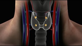 Overview of Parathyroid Disease Causes Symptoms and Treatment for Hyperparathyroidism [upl. by Mcroberts512]