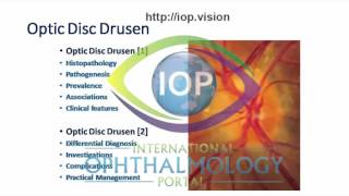 Optic Disc Drusen Part 1 Preview [upl. by Byrne]