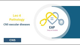 Lec 4  Pathology  CNS vascular diseases  CNS 42 [upl. by Moe]