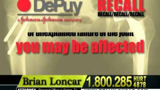 DePuy Hip Replacement Lawsuit  Brian Loncar [upl. by Seymour]