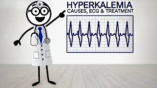 Hyperkalemia Explained Causes ECG Symptoms amp Treatment  ICU Essentials [upl. by Teddi]