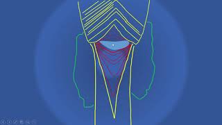 DIVERTICULOS ESOFAGICOS P [upl. by Enovahs]