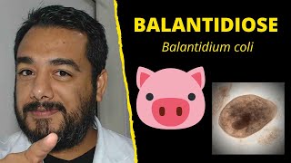 Balantidiose Balantidium coli  Curso de Parasitologia Humana Básica e Clínica  IBAP Cursos [upl. by Fishback396]