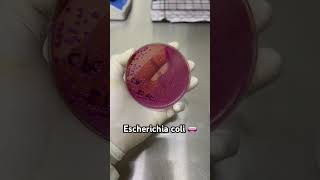 Escherichia coli 🧫🧫🧫 Bacteriologia microbiología [upl. by Julietta863]