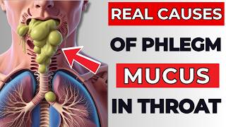 The Real Causes of Constant PHLEGM amp MUCUS In Your Throat [upl. by Azaleah124]