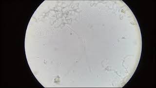 Trichomonas vaginalis pada urin perbesaran 10x parasitology trichomonasvaginalis tlm unisayogya [upl. by Aihsotan921]