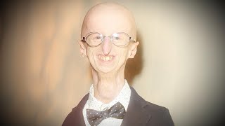 Sammy Basso Oldest Living Person With Progeria Dies at 28 [upl. by Burt]