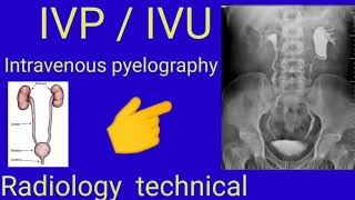 IVP  IVU  Intravenous pyelography  Radiology  Radiography  By BL kumawat [upl. by Kooima]