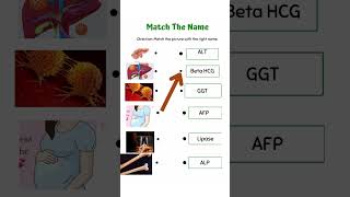 Match the following type question in Biochemistry  Enzyme  protein as diagnostic marker ytshorts [upl. by Jueta]