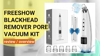 FREESHOW Blackhead Remover Review Does This Pore Vacuum Really Work [upl. by Tloh507]