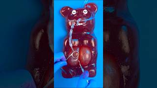 Emergency FruitSurgery Worlds Largest Gummy Bear has 36 babies 💔😓 DiscountDentist FoodSurgery [upl. by Akiaki]