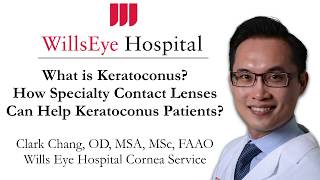 What is Keratoconus How Specialty Contact Lenses Can Help Keratoconus Patients [upl. by Jenn]