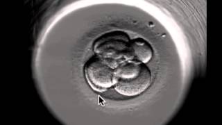 ivf embryo developing over 5 days by fertility Dr Raewyn Teirney [upl. by Akeit]