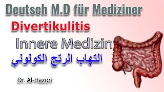 Divertikulitis  Innere Medizin التهاب الرتج الكولوني [upl. by Khalsa764]