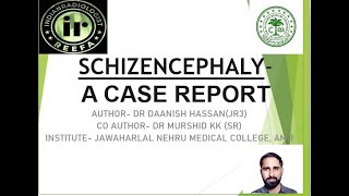 Dr Daanish Hassan quotSCHIZENCEPHALYA CASE REPORTquot [upl. by Shirk]