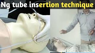 ng tube insertion procedure in hindi step by step Full Explain [upl. by Rahs]