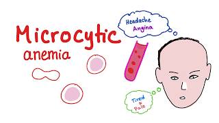 Microcytic Anemia introduction [upl. by Alilak]