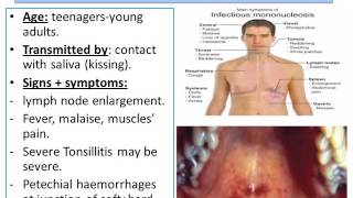 Infections of the Oral Cavity [upl. by Lilian7]