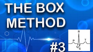 EKG Basics Explained How Do We Interpret A Sinus Rhythm [upl. by Leiruh]