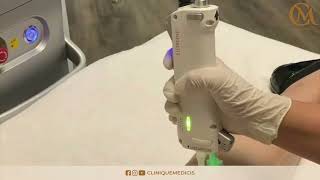 Séance dépilation laser à la Clinique Médicis Paris [upl. by Ludwig673]