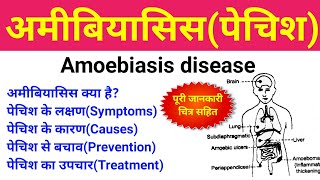 अमीबिएसिस क्या है  amoebiasis treatment symptoms causes  amoebiasis disease in hindi  पेचिश [upl. by Roban]