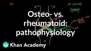 Osteoarthritis vs rheumatoid arthritis pathophysiology  NCLEXRN  Khan Academy [upl. by Tonya]