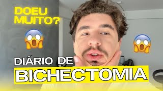 MINHA EXPERIÊNCIA COM A BICHECTOMIA VLOG  VALE A PENA RECUPERAÇÃO E RESULTADO [upl. by Aramo]