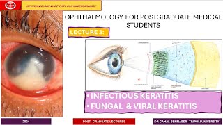 Infectious Keratitis LECTURE 3 Fungal amp Viral KERATITIS [upl. by Studley]