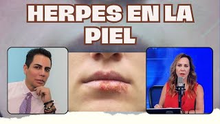 IDENTIFICA los DIFERENTES tipos de HERPES en la PIEL I JAVIER DERMA [upl. by Nived78]