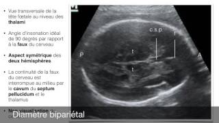 Biométrie fœtale [upl. by Goodkin]