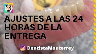 AJUSTES Y Pulido a las 24 Horas 👅PRÓTESIS DENTAL Inferior Parte4 DentaduraCompleta [upl. by Cailly]