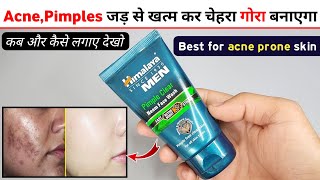 Himalaya Men Pimple Clear Neem Face Wash Review 2024  himalaya neem face wash  himalaya face wash [upl. by Elohcan122]