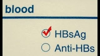 What does HBsAg positive means  HBsAg positive symptoms  HBsAg positive treatment [upl. by Botti]