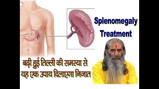 बढ़ी हुई तिल्ली की समस्या से यह उपाय दिलाएगा निजात  Enlarged Spleen Treatment in Ayurveda [upl. by Eirahs241]